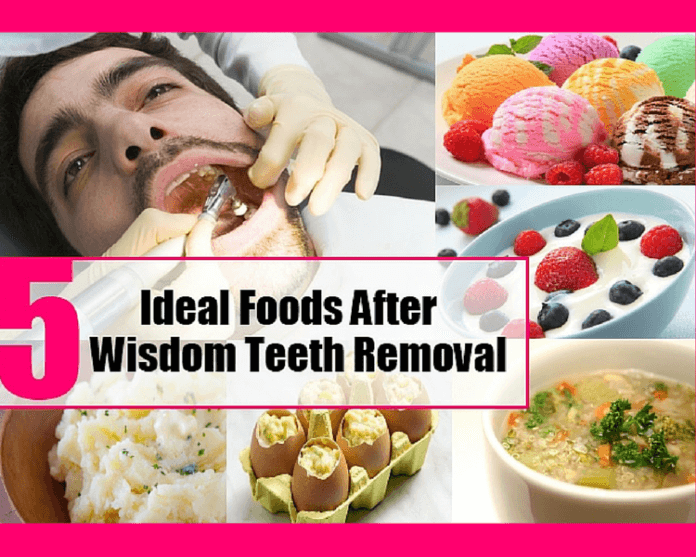 Best Foods to Eat After Tooth Extraction & Wisdom Tooth