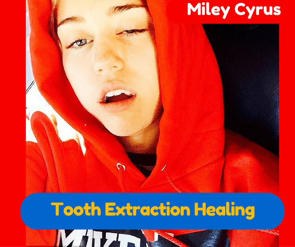 healing tooth extraction process stages